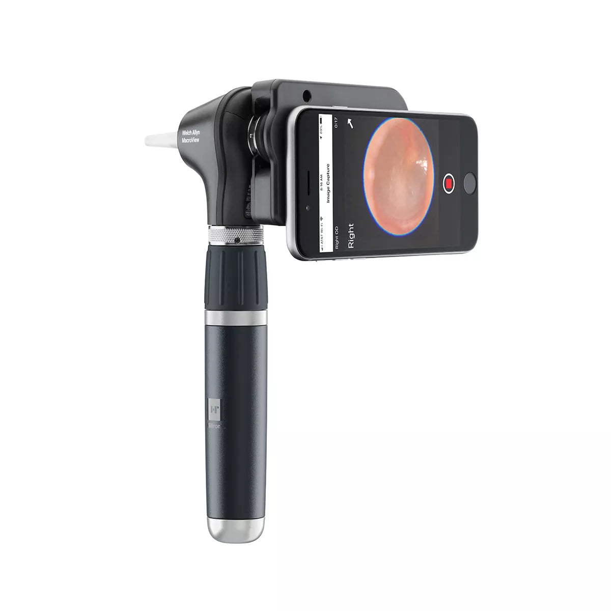 Welch Allyn MacroView Plus Oto for iEx Welch Allyn